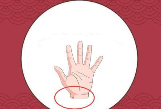 Có 5 nốt ruồi đen trên cơ thể, càng về già càng giàu có Co 5 not ruoi den tren co the, cang ve gia cang giau co