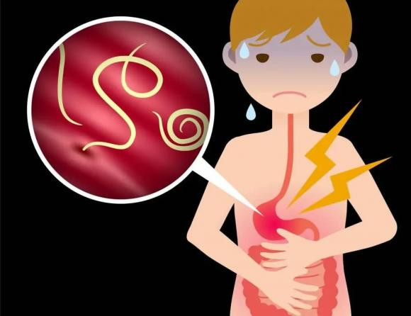 Có nên tẩy giun mỗi năm 1 lần? - Hình 2 Co nen tay giun moi nam 1 lan?-Hinh-2