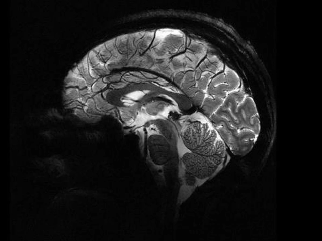Siêu máy quét MRI cho hình ảnh rõ nét nhất về bộ não người Sieu may quet MRI cho hinh anh ro net nhat ve bo nao nguoi