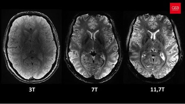 Siêu máy quét MRI cho hình ảnh rõ nét nhất về bộ não người - Hình 2 Sieu may quet MRI cho hinh anh ro net nhat ve bo nao nguoi-Hinh-2