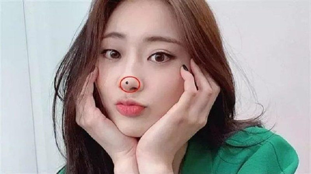 Tướng nốt ruồi ở mũi của đàn ông và phụ nữ khác nhau - Hình 3 Tuong not ruoi o mui cua dan ong va phu nu khac nhau-Hinh-3