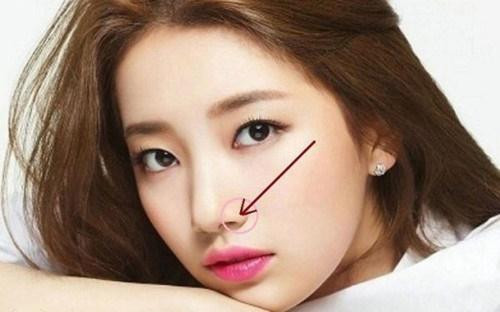 Tướng nốt ruồi ở mũi của đàn ông và phụ nữ khác nhau - Hình 2 Tuong not ruoi o mui cua dan ong va phu nu khac nhau-Hinh-2