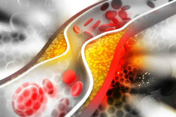 Ăn quá nhiều lòng đỏ trứng có thực sự gây ra dư thừa cholesterol? - Hình 2 An qua nhieu long do trung co thuc su gay ra du thua cholesterol?-Hinh-2