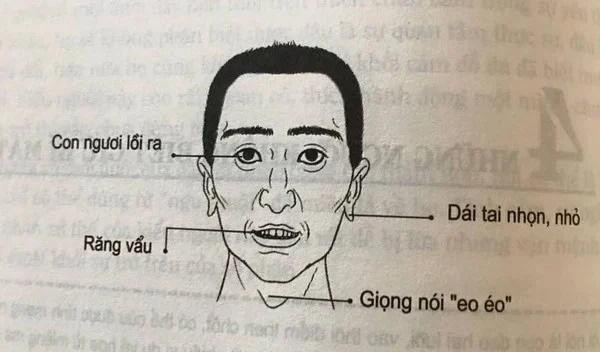 Người đàn ông có một trong những tướng này, nên tránh xa - Hình 2 Nguoi dan ong co mot trong nhung tuong nay, nen tranh xa-Hinh-2