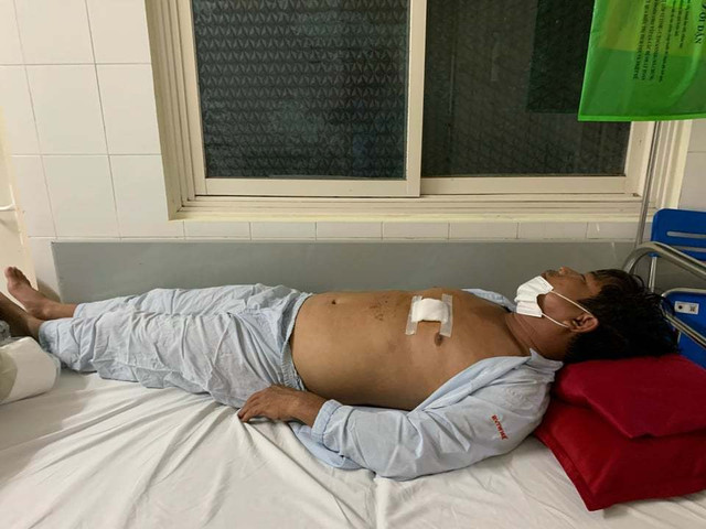 Mâu thuẫn tấc đất, anh trai dùng kéo đâm em nhập viện - Hình 2 Mau thuan tac dat, anh trai dung keo dam em nhap vien-Hinh-2
