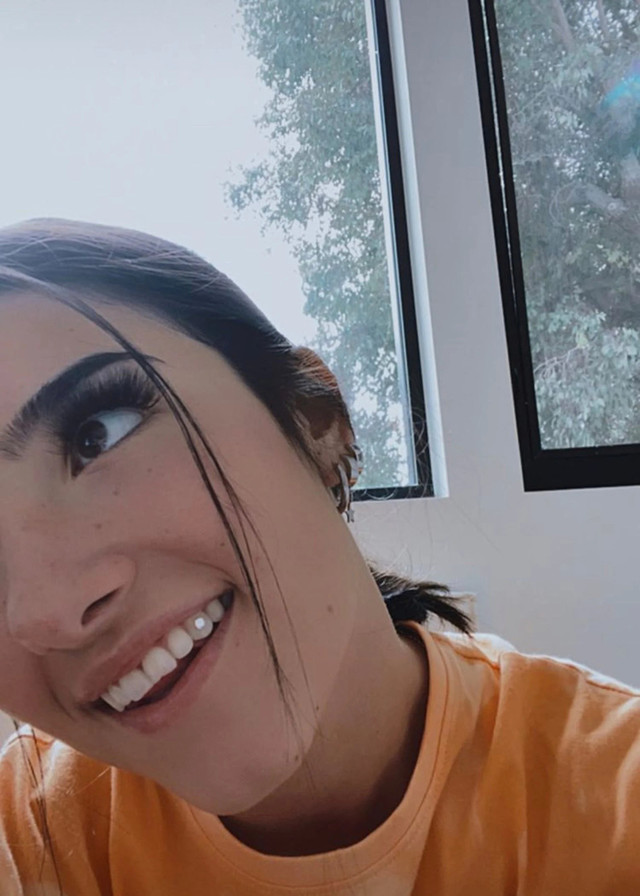 Bất chấp nguy hiểm để chạy theo mốt gắn đá quý vào răng trên TikTok - Hình 3 Bat chap nguy hiem de chay theo mot gan da quy vao rang tren TikTok-Hinh-3