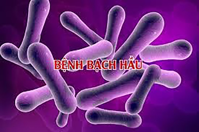 Kon Tum: Phát hiện 3 ca dương tính với bệnh bạch hầu Kon Tum: Phat hien 3 ca duong tinh voi benh bach hau