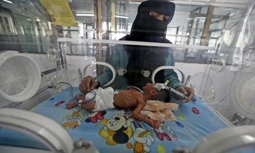 Đất nước Yemen tang tóc điêu tàn trong không kích