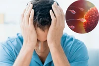 Hiểm họa vô sinh từ thói quen sinh hoạt ở nam giới