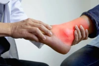 Lý do khiến người trẻ dễ mắc gút