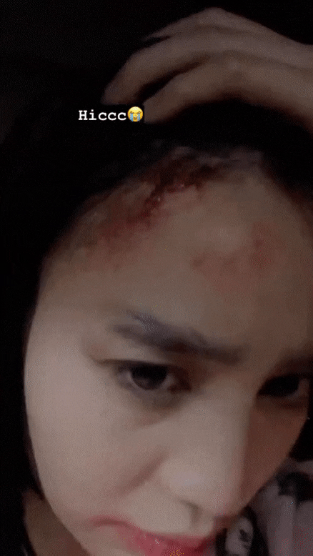 Ninh Duong Lan Ngoc gay hoang mang khi dang clip dau toac mau