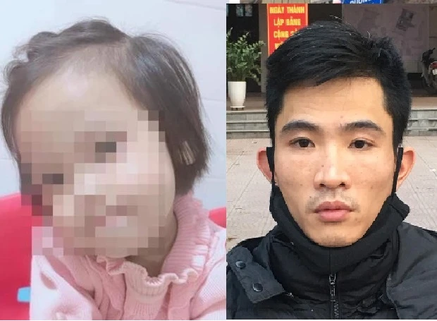 Toàn cảnh vụ bé gái 3 tuổi tử vong do bị đóng đinh vào đầu