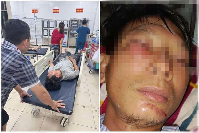 Anh H. bị chấn thương nặng đang được điều trị, theo dõi tại Bệnh viện Đa khoa Hà Tĩnh. Anh H. bị chấn thương nặng đang được điều trị, theo dõi tại Bệnh viện Đa khoa Hà Tĩnh.