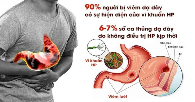 Ảnh minh họa/ Nguồn internet z6851000743573-4bcd97bc21e765b08fa5d0c7a775e7c2.jpg