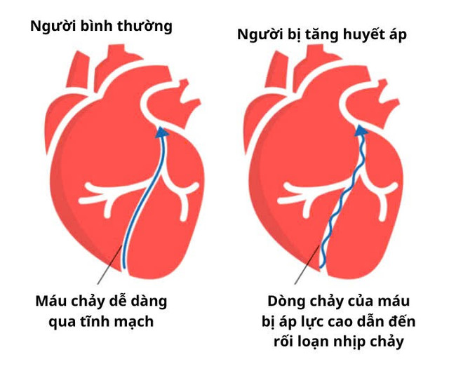 Ảnh minh họa/ Nguồn internet z6863151142658-af23a9ca54313577568260b2fc6a4955.jpg