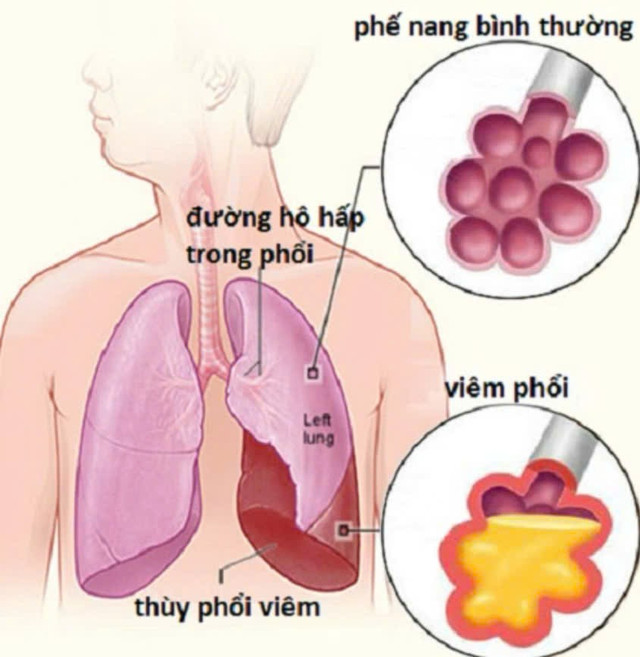 p1.jpg