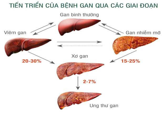 Ảnh minh họa/ Nguồn Internet as1.jpg