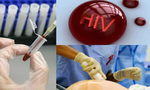 Điểm mặt những vụ công an, bác sĩ phơi nhiễm HIV kinh hoàng ở VN
