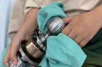 Bé trai vào viện cấp cứu cùng ổ khóa dính chặt ngón tay