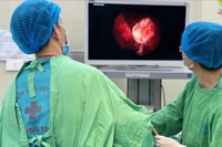 Răng mọc lạc chỗ vào xoang hàm, tình trạng hiếm gặp, có thể gây biến chứng