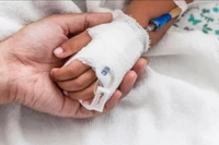 Não mô cầu có thể diễn tiến nặng chỉ trong 24 giờ 