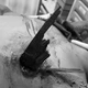 Cứu sống nam thanh niên bị gỗ đâm thấu ngực ở Quảng Bình