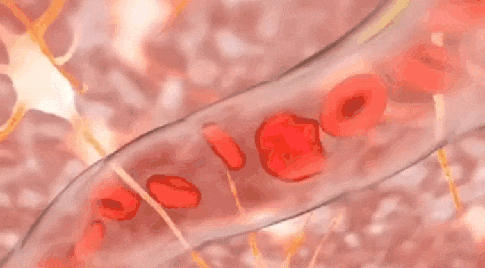 Trà thuốc chữa đau đầu, ù tai do thiểu năng tuần hoàn não