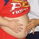 TP HCM gia tăng tỷ lệ trẻ béo phì 
