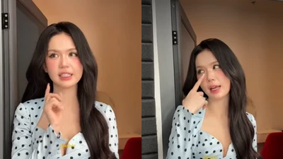 'Nữ hoàng nội y' Ngọc Trinh công khai can thiệp thẩm mỹ?