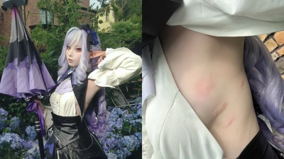 Hết mình vì đam mê, nữ coser lộ ảnh "làm mồi" cho muỗi