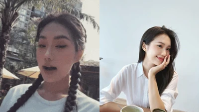 Doãn Hải My liên tiếp dính nghi vấn "dao kéo"