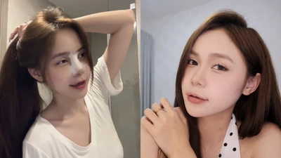 Hot Tiktoker La Hoàng Kỳ Duyên sửa mũi để "nâng tầm" nhan sắc