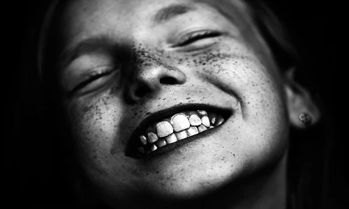 Những “thiên thần mặt rỗ” cuốn hút đến ngỡ ngàng