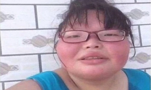 Cô gái xấu xí bất ngờ trở thành hoa khôi đại học