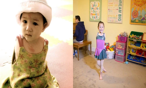 Em bé không tay xinh như thiên thần ngày ấy - bây giờ