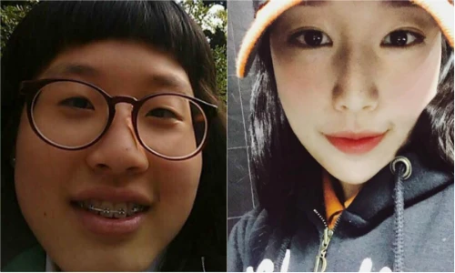 Xấu xí và bị "đá", cô gái Hàn lột xác thành hot girl