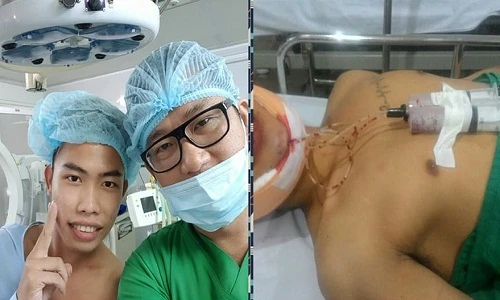 "Thảm họa mạng" Tùng Sơn dao kéo để trông bớt xấu?