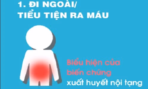 Dấu hiệu khi mắc sốt xuất huyết cần nhập viện ngay 