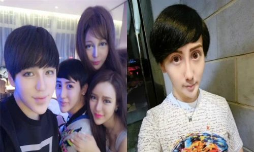 Bầy “yêu tinh” nghiện phẫu thuật thẩm mỹ gây sốc