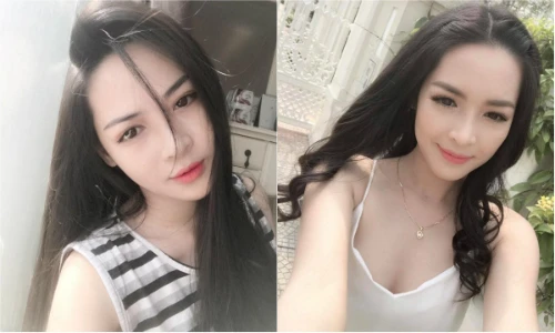 Hot girl Nam Định ước tính "xây lại mặt" hết 1,5 tỷ