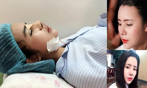 9X Hà thành bị tiêm nhầm silicon và bài học xương máu