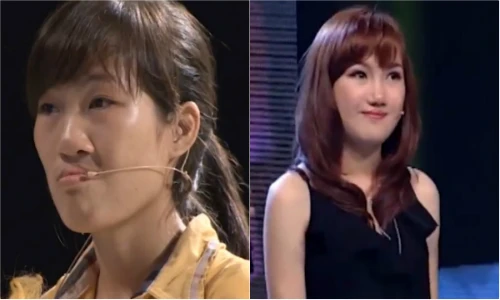 Cô gái Thái Nguyên mặt lệch lột xác thành mỹ nhân