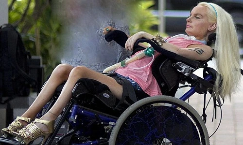 Cô gái bị liệt ôm mộng “biến hình” thành búp bê Barbie