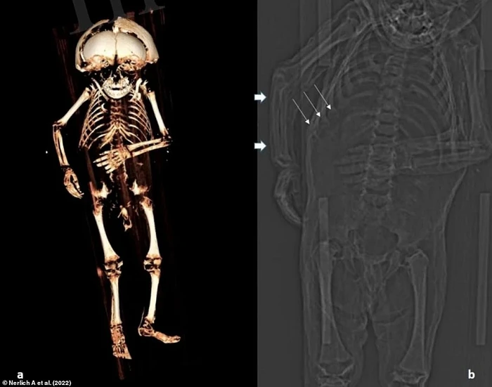 Nóng: Giải mã thành công xác ướp bé trai chôn cách đây 400 năm 
