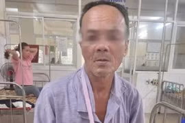 Người đàn ông nhập viện vì bị khỉ xông vào nhà và tấn công