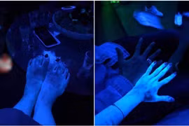  Đi pub cùng với hội bạn, tay chân cô gái bỗng phát sáng như zoombie