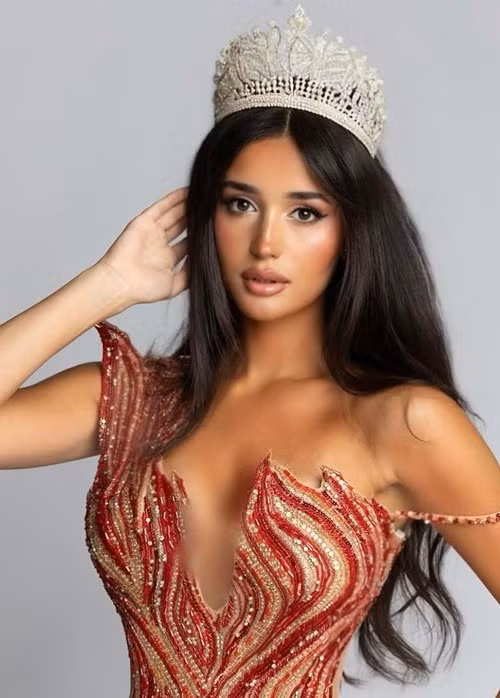 Top 5 Hoa hậu Quốc tế 2025 theo dự đoán của Missosology còn gồm Hilda Gutierrez (Guatemala), Ana Dedvukaj (Montenegro) và Lara Doval (Đức). Trong ảnh là đại diện Montenegro. Ảnh: Fanpage Hoa hậu Quốc tế.