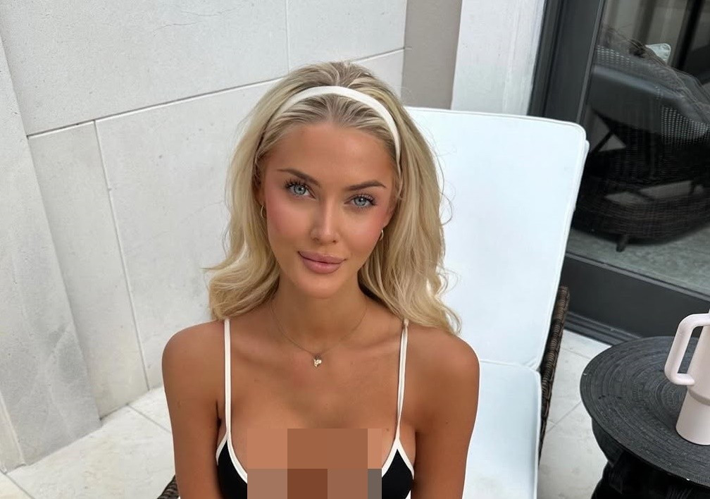 Sau khi đăng quang Hoa hậu Hoàn vũ Thế giới 2024, Victoria thăng hạng nhan sắc. Ảnh: Instagram Victoria.