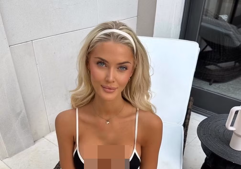 Sau khi đăng quang Hoa hậu Hoàn vũ Thế giới 2024, Victoria thăng hạng nhan sắc. Ảnh: Instagram Victoria.