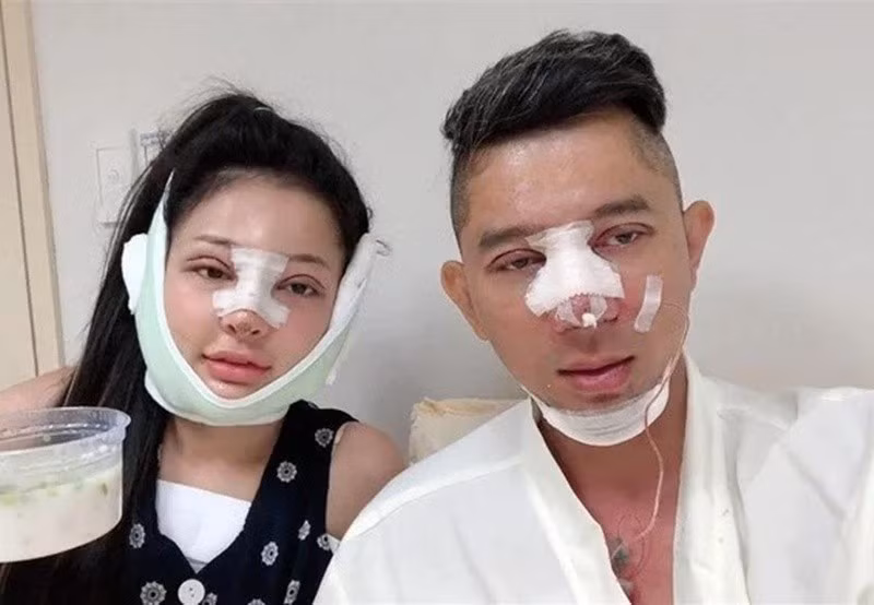 Năm 2019, Lương Bằng Quang cùng Ngân 98 phẫu thuật thẩm mỹ gương mặt. Ảnh: Saostar.